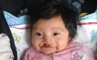 Ayuda para que mi hija vuelva a sonreír sin taparse la boca